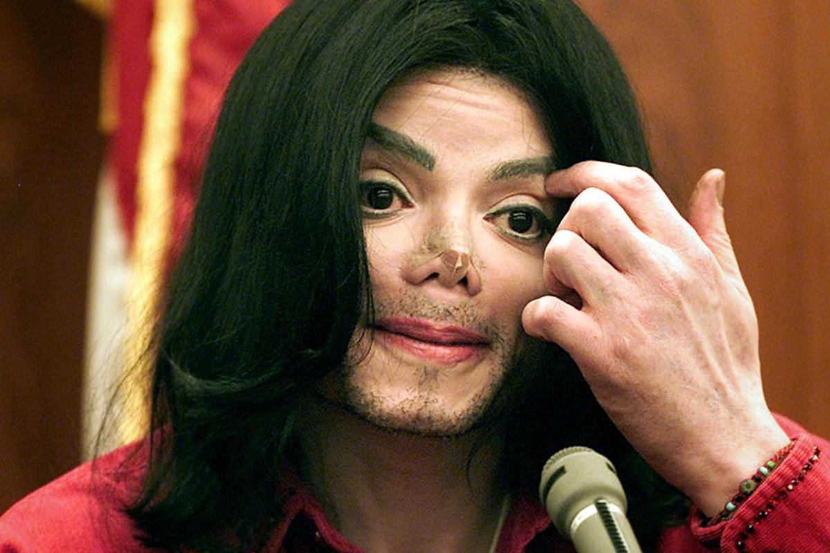 Michael Jackson with a Band-Aid over the spot where his nose used to be