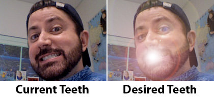 Dave Teeth