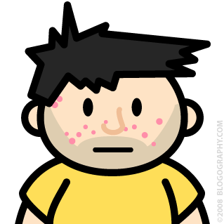 DAVETOON: Lil' Dave with little pink scars.