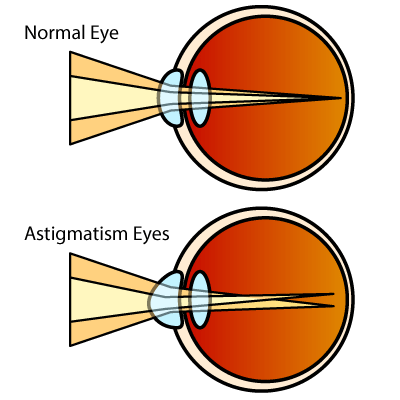 Eyeballs!