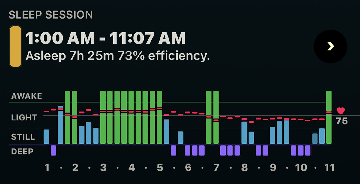 My sleep data graph via the AutoSleep app on my Apple Watch.