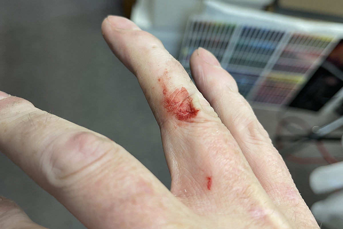 A cut on my right hand.