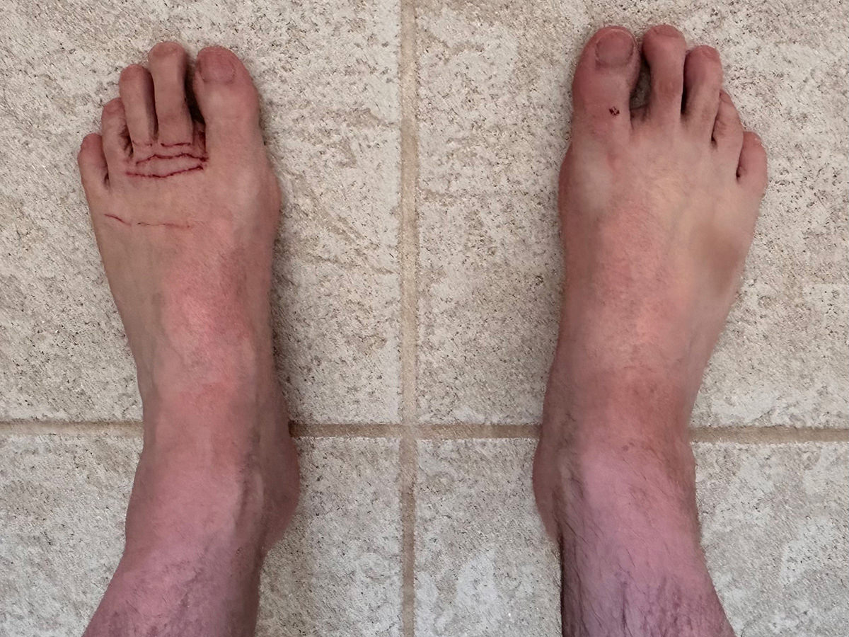 My feet cut up.